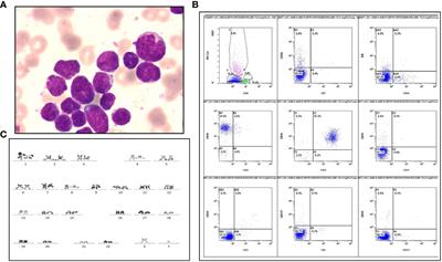 Case Report: A novel FGFR1 fusion in acute B-lymphoblastic leukemia identified by RNA sequencing